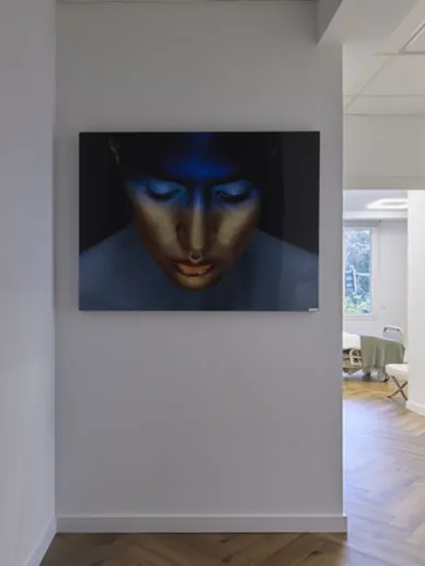 Pasillo de la clínica que conduce a una habitación de pacientes en Ocean Clinic Marbella