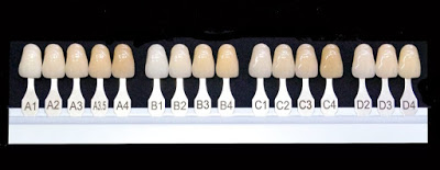 Entender por qué sus dientes están descoloridos