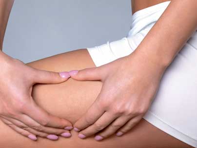 Tratamientos eliminar celulitis Marbella Ocean Clinic