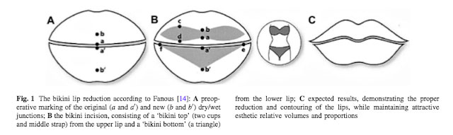 Técnica de reducción del labios