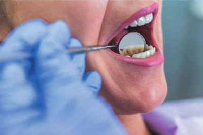 Tratamiento Dental - Estética Dental