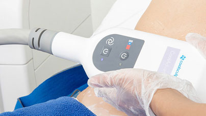 Coolsculpting, lo mejor para la pérdida de grasa