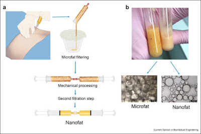 The nanofat is obtained by extracting fat from a donor site