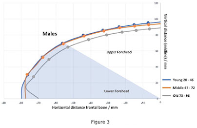 Aging of the Forehead Bone, fig.2 | Marbella Ocean Clinic