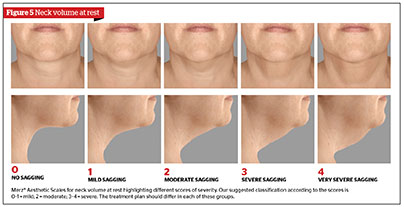 A Systematic Approach to Non-Surgical Neck Rejuvenation, figure-5 | Gabriela Casabona Ocean Clinic