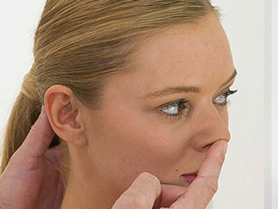 Rhinoplasty - Nasal tip surgery