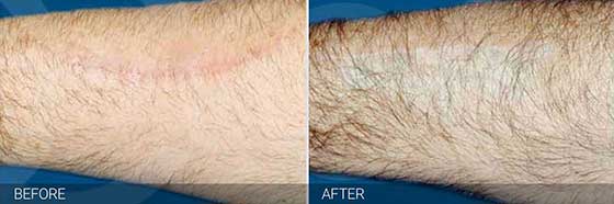 Non-surgical correction
