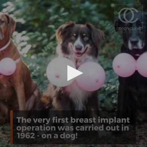 Breast implant