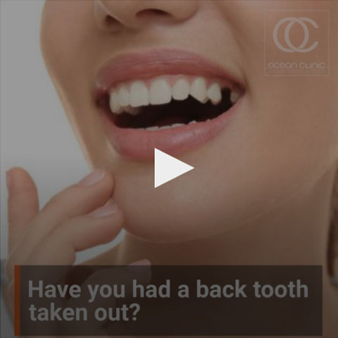 Tooth Loss