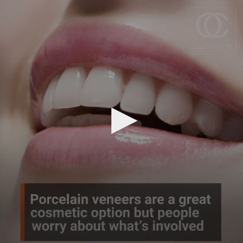 Porcelain veneers