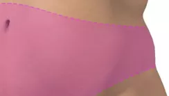 Liposucción: Abdomen, Brazo, Cuello, Glúteos, Muslo