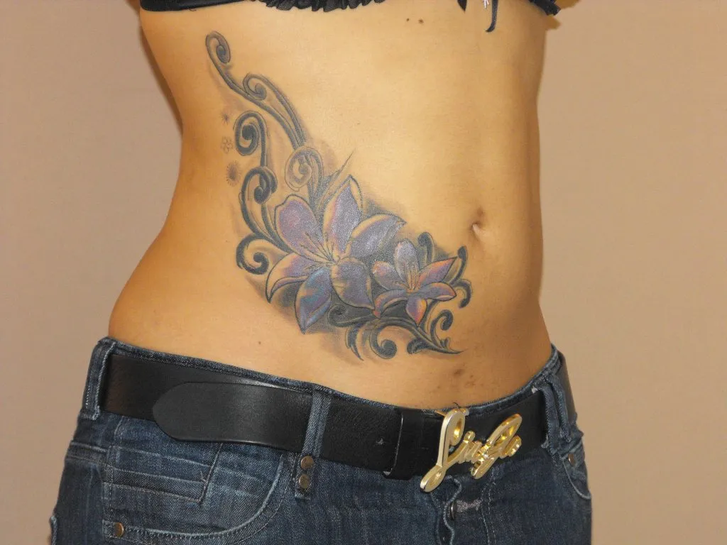 Resultado después de Liposucción – vista lateral