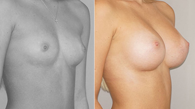 Before & After Actual clinical cases with before and after photographs. Marbella Madrid