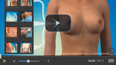 Multimedia Explanations of the main treatments... Marbella Madrid