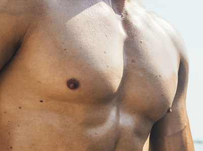 Gynecomastia plastic surgery for men Marbella and Madrid. Ocean Clinic