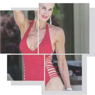 Candidato ideal liposucción Marbella evaluación corporal